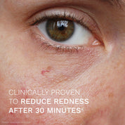 Evercalm™ Redness Relief Serum